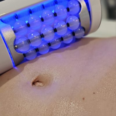 Endosferische massage